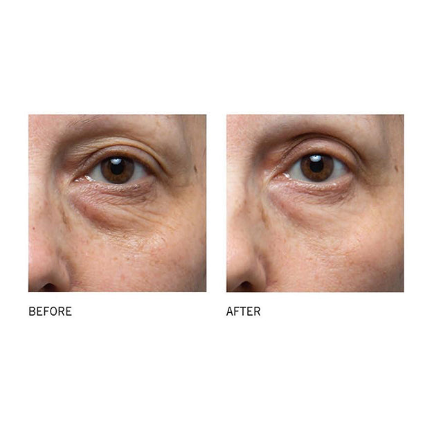 iS Clinical - C Eye Serum Advance+ (15ml)